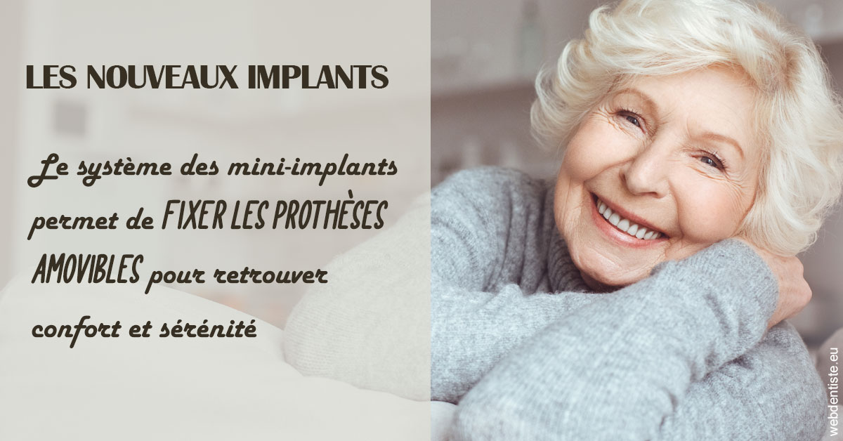 https://www.docteur-mandalova.fr/Les nouveaux implants 1