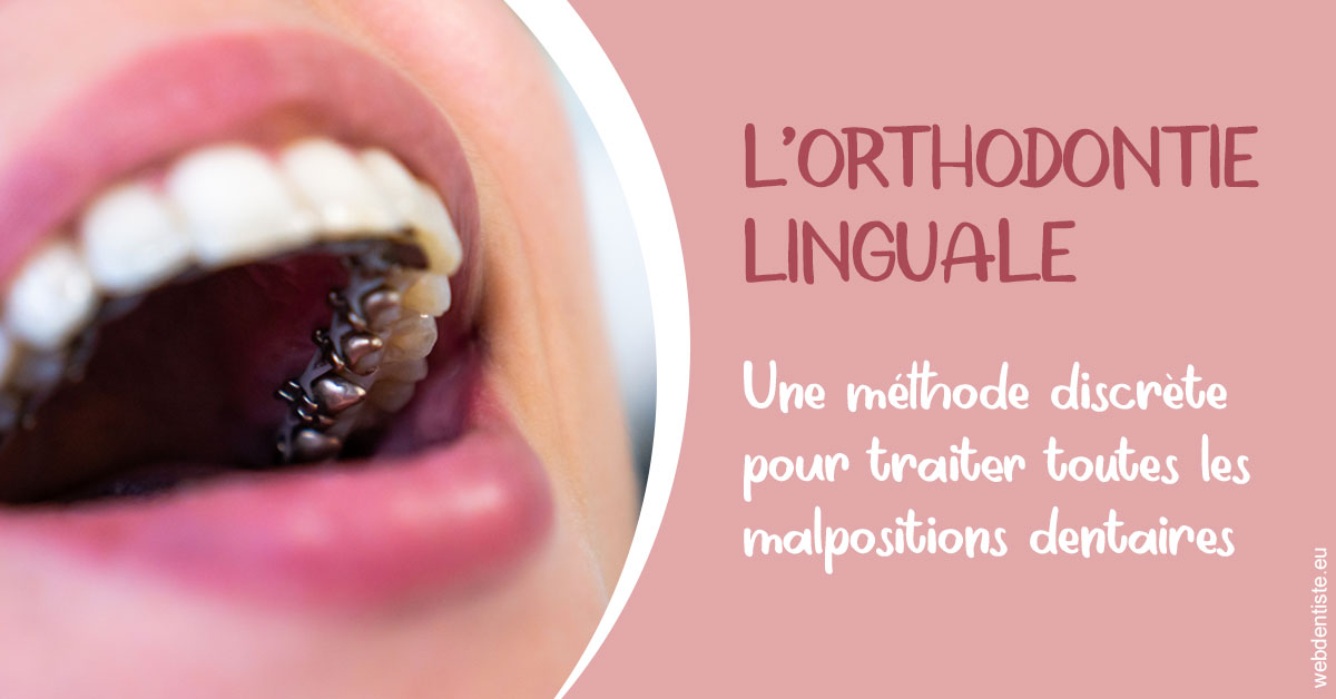 https://www.docteur-mandalova.fr/L'orthodontie linguale 2