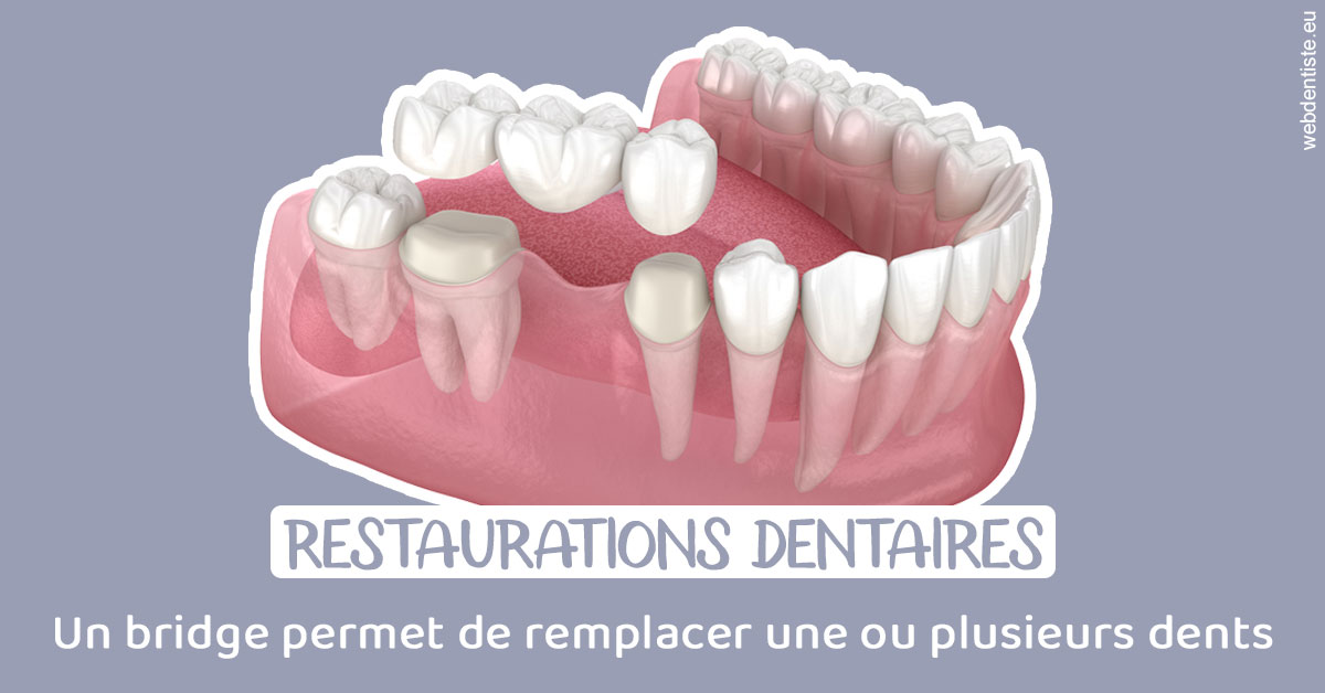 https://www.docteur-mandalova.fr/Bridge remplacer dents 1