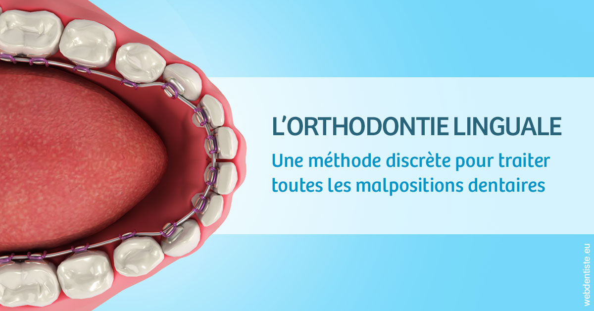 https://www.docteur-mandalova.fr/L'orthodontie linguale 1