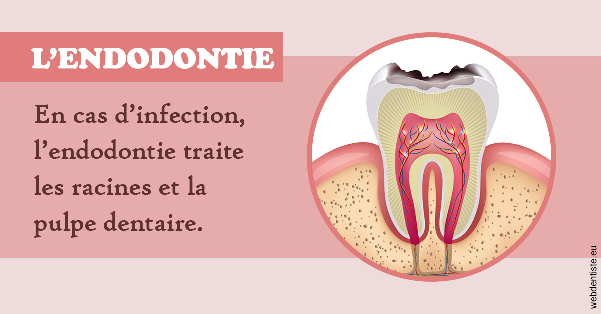 https://www.docteur-mandalova.fr/L'endodontie 2