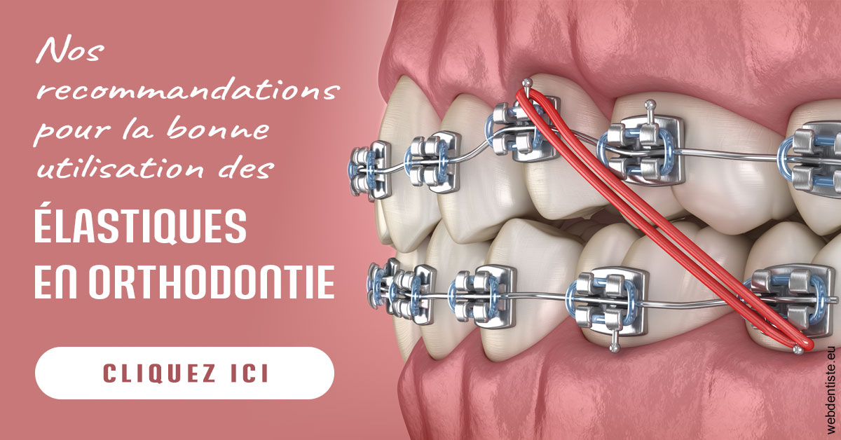 https://www.docteur-mandalova.fr/Elastiques orthodontie 2